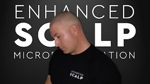 Enhanced Scalp Micropigmentation | Enhanced Pigment Academy | SMP Training place picture