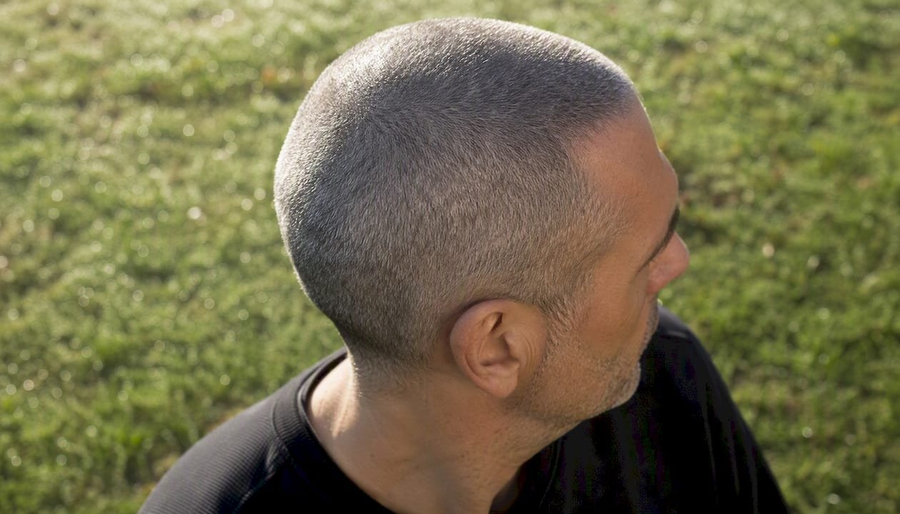 Close-up of SMP on buzzed gray hair