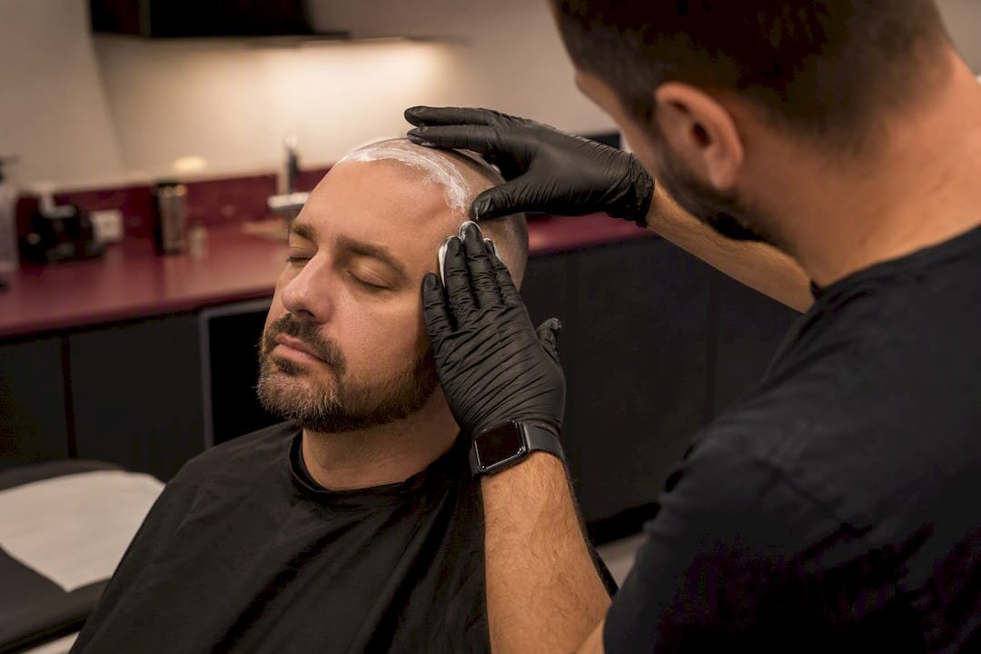 Applying numbing cream before SMP treatment