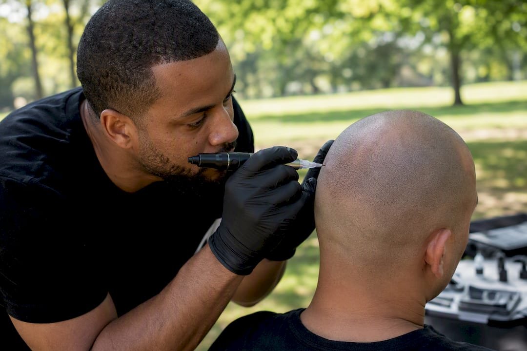 Hands applying SMP training on scalp