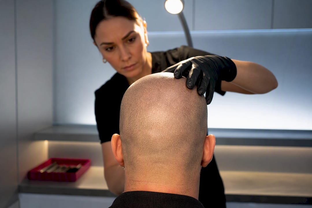 Clinician assessing healed SMP scalp coverage
