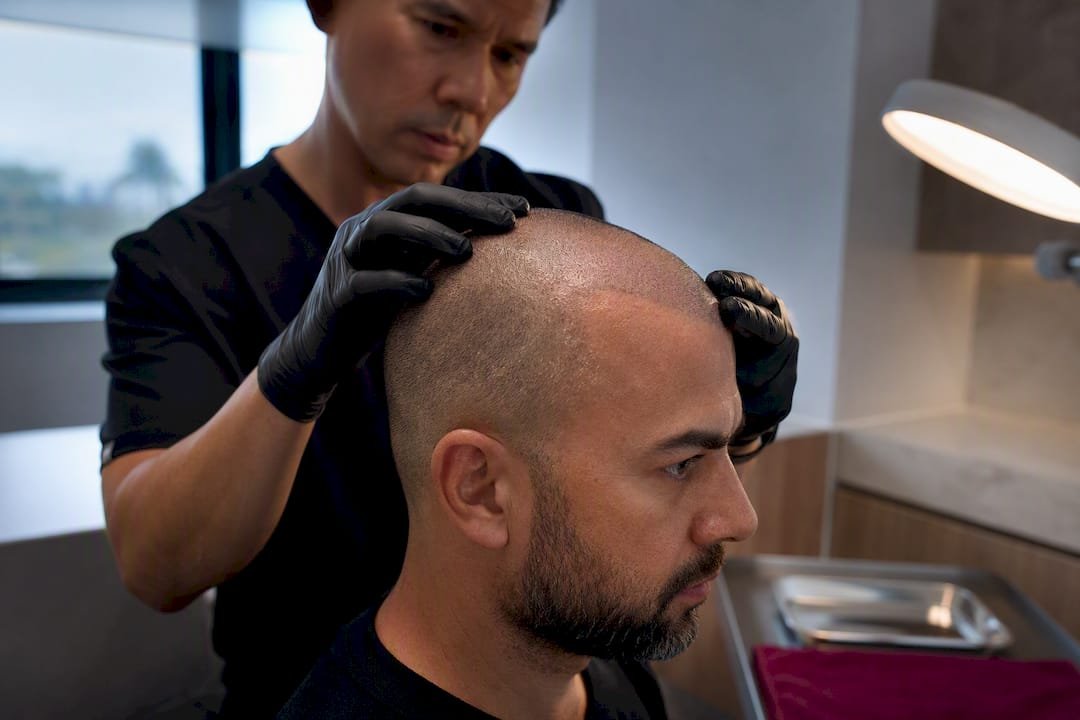 Scalp stability assessment before SMP treatment